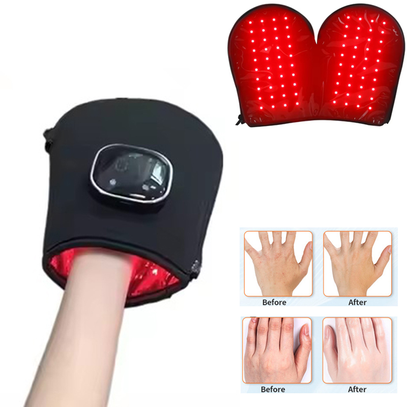 Galvanic Skin Sensor - อุปกรณ์บำบัดด้วยแสงสีแดงรุ่นใหม่สำหรับมือ ไฟ LED ใกล้รังสีอินฟราเรด บำรุงผิว ชาร์จผ่าน